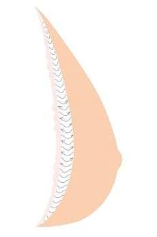 3-layer-bf-adapt-illu-ai-orez.jpg